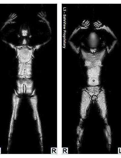 body scanner