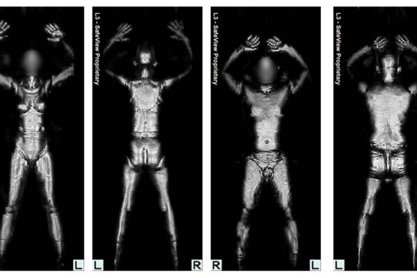 body scanner