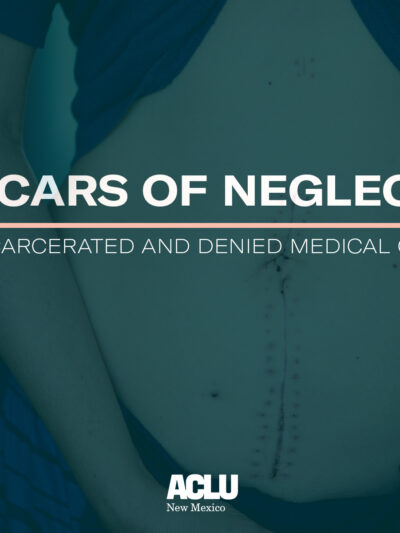 Scars of Neglect