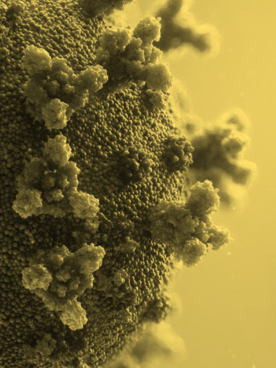 Lessons Learned: COVID-19 and Incarceration in New Mexico. Picture of Coronavirus.