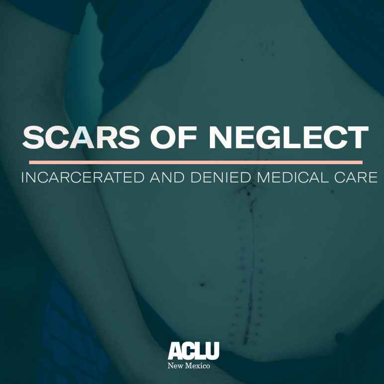 Scars of Neglect
